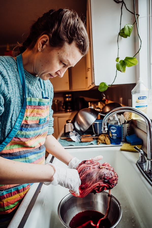 Woman pulling back membrane of placenta